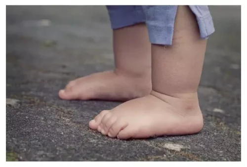 무좀 치료제 추천 및 예방 습관 키우기