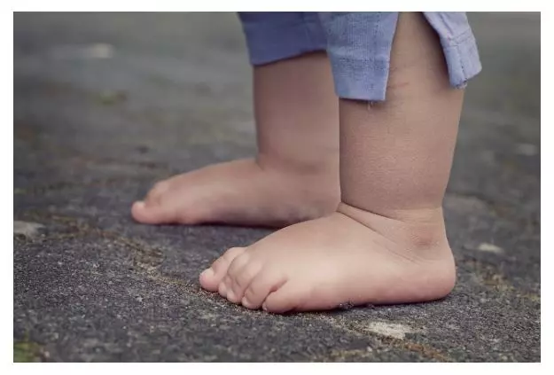 무좀 치료제 추천 및 예방 습관 키우기 무좀 치료제 추천 및 예방 습관 키우기