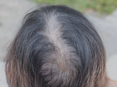 두피모발관리지도사 하는 일